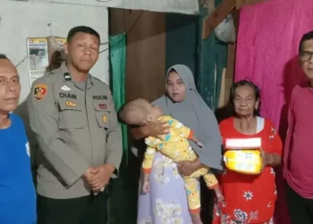 Terima Informasi Mendadak, Polisi di Padang Ini Buru-buru Kunjungi Anak Penderita Hidrosefalus