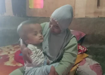 Nestapa Hanif, Balita Penderita Hidrosefalus Tak Tersentuh Bantuan Pemerintah