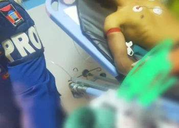 Tragis, Jari Tangan Pemuda Asal Dharmasraya Terjepit Mesin Penggiling Daging