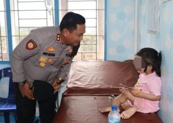 Tante Korban Jadi Tersangka Kasus Bocah Dianiaya Hingga Cacat