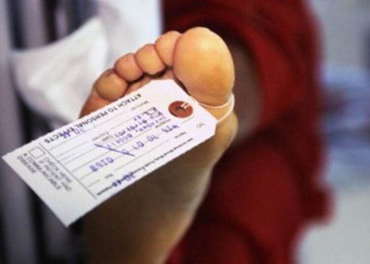 Ilustrasi kaki manusia. Foto: Corbis.com