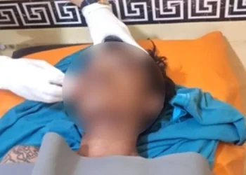 Jambret di Pariaman Tewas Sebelum Resmi Jadi Tersangka Polisi, Luka-Luka Akibat Jatuh dan Amukan Warga