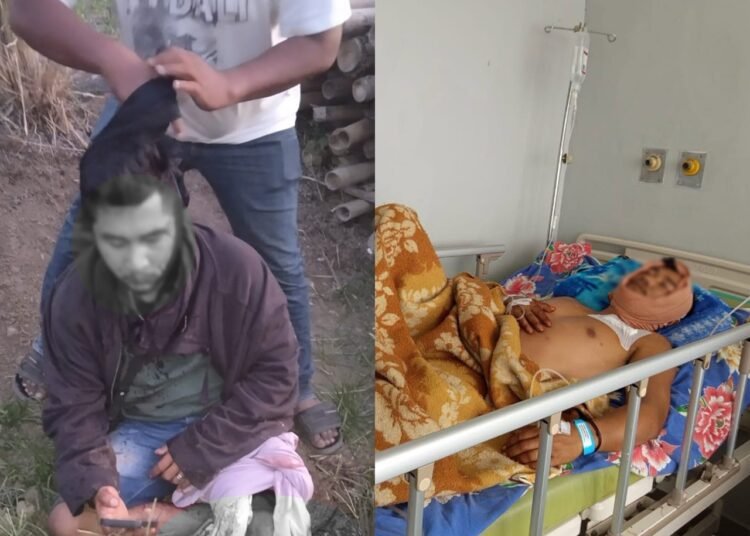 Salah satu korban pembacokan di Agam. (foto: IST).