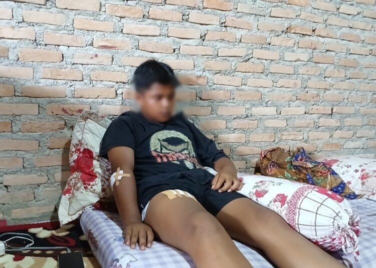 Raihan Maulana Putra (13), Siswa di MTsN 3 Kota Padang, sedang istirahat di rumahnya di Aia Dingin, Kelurahan Balai Gadang, Kecamatan Koto Tangah, Kota Padang, Kamis (25/7/2025). Ia mengalami luka serius setelah dibacok orang pada Jumat (18/7/2025). Foto: Dharma Harisa
