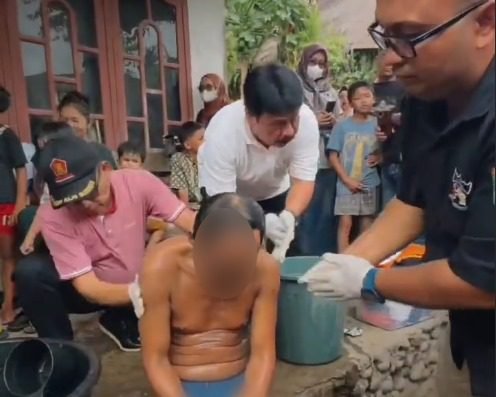 Roni Aries (42), ODGJ asal Korong Tampunik, Nagari Singguliang, Padang Pariaman, yang sebelumnya dipasung kini mulai mendapatkan perawatan dari pemerintah daerah.