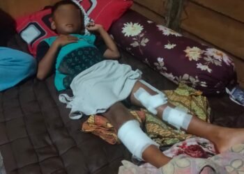 Mandi di Pantai, Bocah 7 Tahun di Pasaman Barat Diserang Buaya