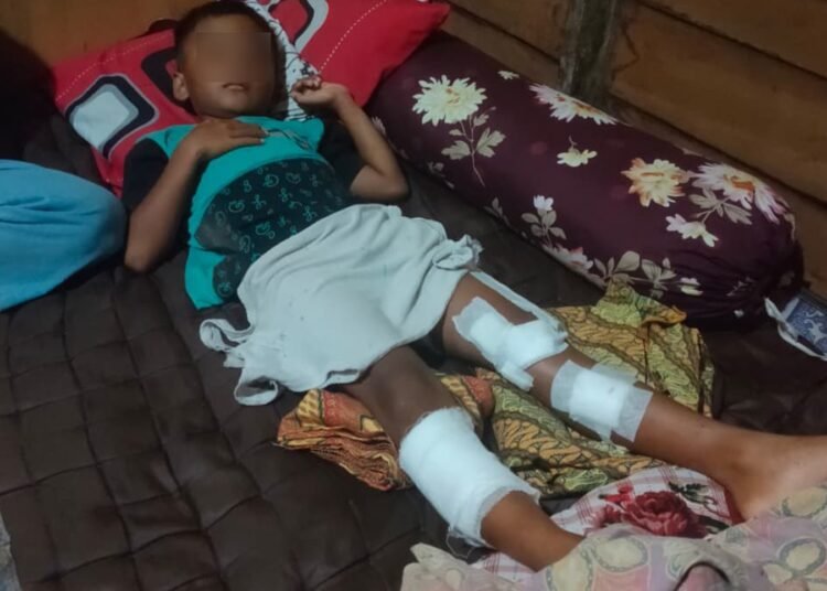 Seorang anak berusia 7 tahun mendapatkan perawatan medis setelah diserang buaya saat mandi di Pantai Air Bangis, Jorong Kampung Padang Utara, Nagari Air Bangis, Kecamatan Sungai Beremas, Kabupaten Pasaman Barat, pada Senin (16/12).