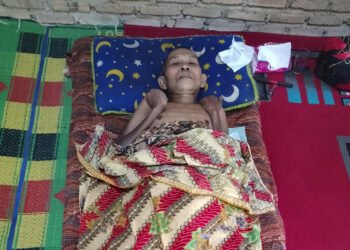 Kisah Jopri di Pasaman, Setahun Terbaring Lumpuh Usai Tertimpa Kayu, Keluarga Berharap Bantuan