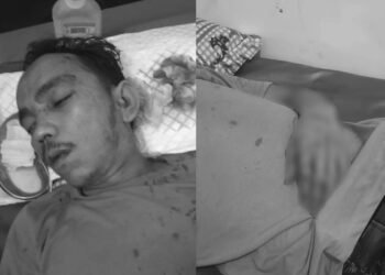 Sopir Travel Pekanbaru Dikeroyok di Limapuluh Kota, Korban dan Pengeroyok Lapor Polisi