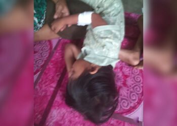 Anak 4,5 Tahun di Padang Jadi Korban Gigitan Anjing Liar, Begini Kondisinya