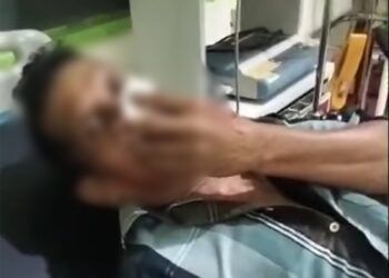 Pria Paruh Baya di Padang Diserang OTK Bersenjata Tajam, Luka Robek pada Wajah