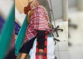 2 Sepeda Motor yang Dikendarai Ibu-Ibu Tabrakan di Payakumbuh, Satu Korban Patah Tulang