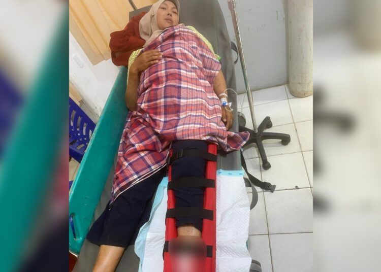 Seorang ibu rumah tangga mengalami patah tulang kaki kiri setelah sepeda motor yang dikendarainya ditabrak kendaraan lain dari arah berlawanan di Jalan Kamboja, Kelurahan Subarang Batuang, Kecamatan Payakumbuh Barat, Payakumbuh, pada Jumat (24/7/2026) sekira pukul 11.00 WIB. Foto: Polres Payakumbuh