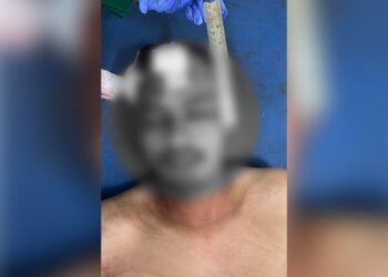 Pria di Agam Ditemukan Bersimbah Darah di Pacuan Kuda Ambacang, Keluarga Sebut Korban Dibacok OTK
