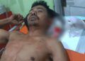 Dibacok di Ladang, Pria di Agam Berlumuran Darah Tiba di Rumah, Istri Lapor ke Polres