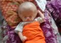 Kepala Membesar karena Hidrosefalus, Bayi 23 Hari di Pesisir Selatan Butuh Bantuan Biaya Perawatan