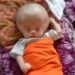 Kepala Membesar karena Hidrosefalus, Bayi 23 Hari di Pesisir Selatan Butuh Bantuan Biaya Perawatan