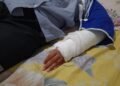 Siswi SD di Pasaman Alami Patah Pergelangan Tangan, Diduga Akibat Didorong Teman Saat Olahraga