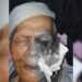 Gusnali, Lansia di Solok Derita Tumor Ganas, Terkendala Biaya Pengobatan Rp100 Juta