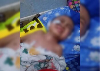 Terkendala Biaya Pengobatan, Ibu Balita Korban Penganiayaan Ayah Tiri Asal Solok Tulis Surat Terbuka kepada Kang Dedi Mulyadi